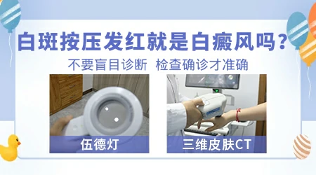 白斑使劲按压会变红会不会是白癜风