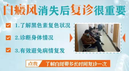 白癜风要定期复查哪些项目 多久查一次