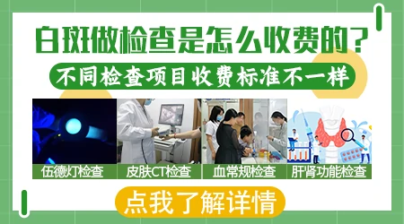 去医院检查皮肤白斑大概花多少钱
