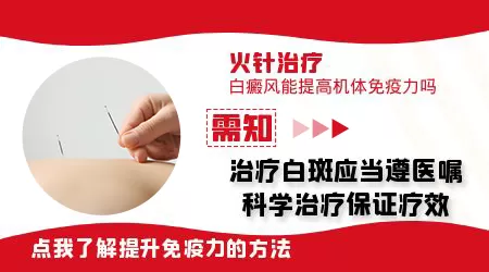 稳定期白癜风用火针效果好不好