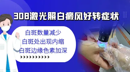 男性私处部位的白斑照308激光吗