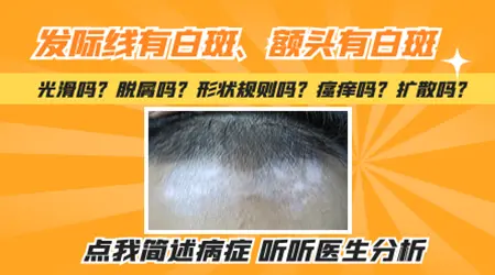 额头发际线边缘一道白越来越大怎么回事