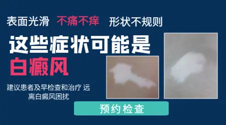身上的白斑不疼不痒是不是就不用管