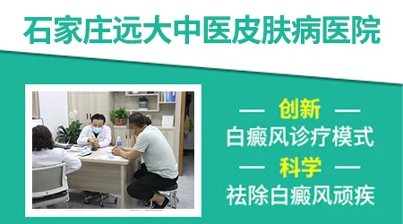 同形反应出现是不是说明白癜风在进展