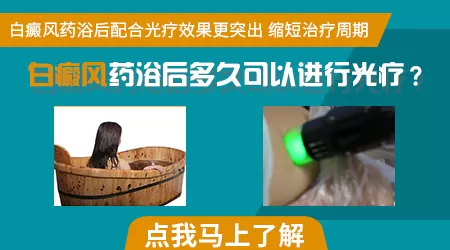 窄谱UVB光疗适合大面积白癜风白斑吗