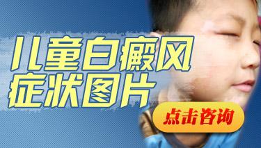 儿童手臂小片白癜风只擦他克莫司可以吗