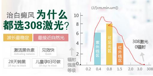 儿童治疗白癜风能做308激光吗