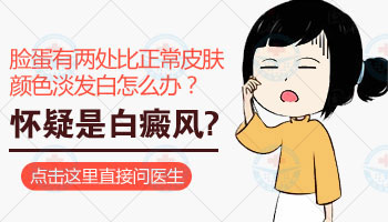 小孩脸上有白斑是怎么回事