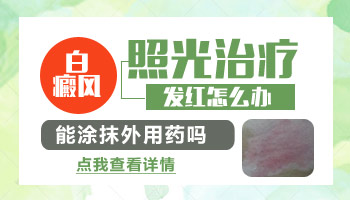 宝宝白癜风照308激光有好转但还是发红是为什么