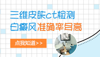 宝宝白斑做ct检查是白癜风准确吗