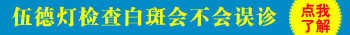 宝宝身上有白点检查是不是白癜风照伍德灯有危害吗