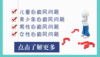 儿童白癜风一定要边界清晰才是好转吗