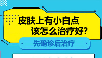 孩子脸上有指甲盖那么大的白斑怎么治