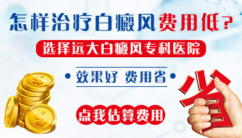 如何节省儿童白癜风的治疗费用