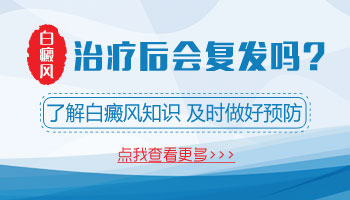 儿童白癜风复发的表现有哪些