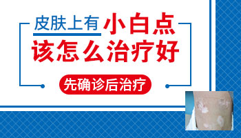 小孩背部有一些白点肚子上也有一点怎么治