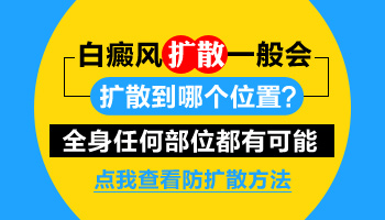 小孩嘴角有点白癜风会扩散到满脸都是吗