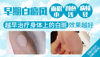 为什么小孩嘴一圈发白