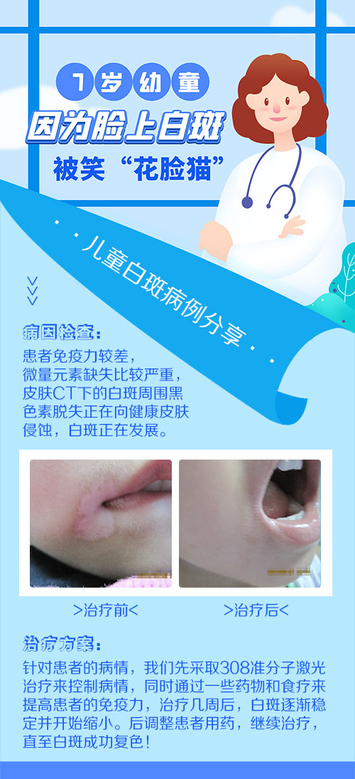 儿童脸上和腋下有白块是得了白癜风吗