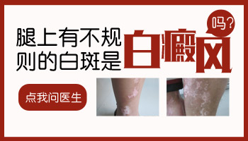 宝宝大腿根部有块白色的斑代表什么