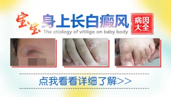 宝宝大腿根部有块白色的斑代表什么