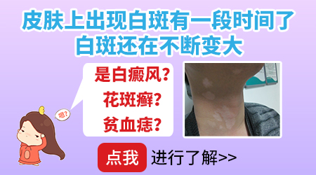 儿童腿关节和腋窝里有几个白点还长大了