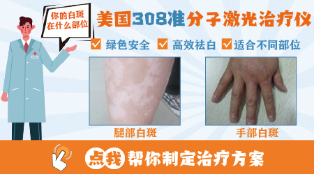 小孩大腿内侧有白斑块