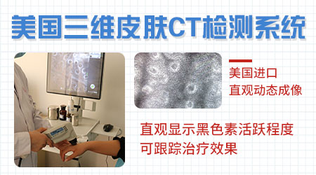 儿子脖子下面有点白块是什么类型的白斑