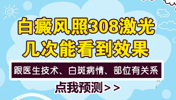 儿童白癜风做308激光几次才可以看到效果