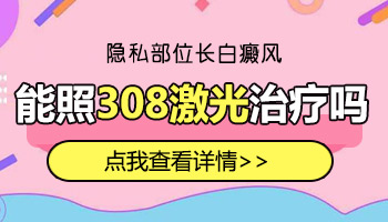 包皮上的白癜风有一个月了能照家用308吗