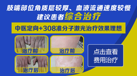 男性脚裸有白斑怎么治疗