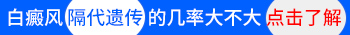 有白癜风的人生的孩子健不健康