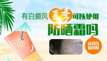 女性白癜风患者夏季用什么防晒霜