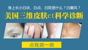 女性腿上长小小的白斑是什么原因