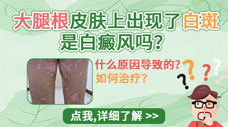 女性大腿内侧出现白色斑块是什么