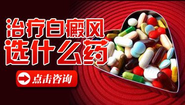 哪些治疗青少年白癜风的方法好