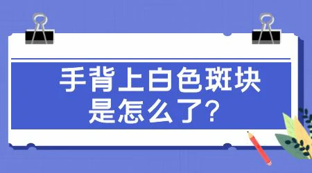 手背有一块硬币大白癜风怎么治疗才能快速见效