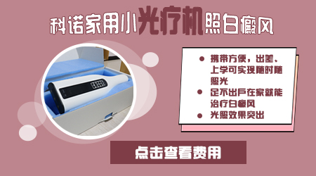 有新发白斑买什么308光疗仪好