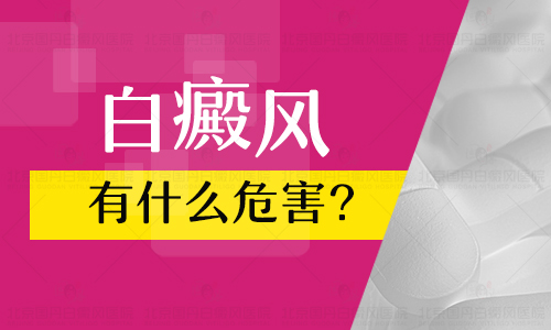 多年的白癜风在脸上不治会不会扩散