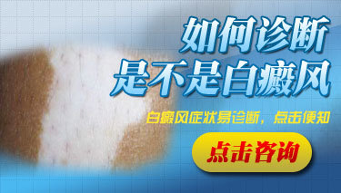 我身上起白斑如何确定是不是白癜风