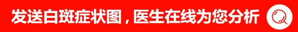 白癜风的检查费用大约需要多少钱