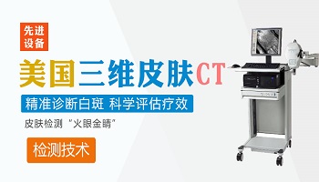 检查白癜风照个伍德灯就行了吗ct还用照吗