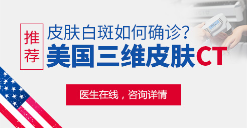 怎样查验脖子上的白块是不是白癜风