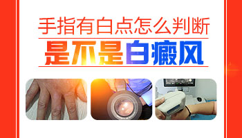 手背上隐隐约约的好多白斑是怎么回事