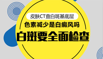 白斑照伍德灯显示灰白色是不是白癜风