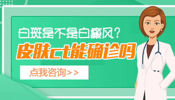 儿童额头有白斑不太明显是白癜风吗