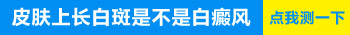 怀孕后四肢长白点是不是得了白癜风