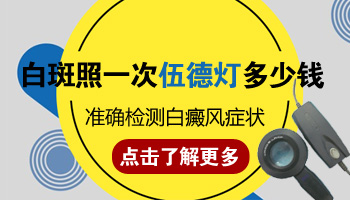 伍德灯下浅蓝白色荧光是否是白癜风