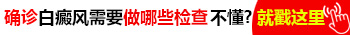 伍德灯检查白斑是阳性蓝白色是白癜风吗