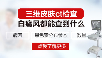 怀疑是白癜风做检查需要多少钱